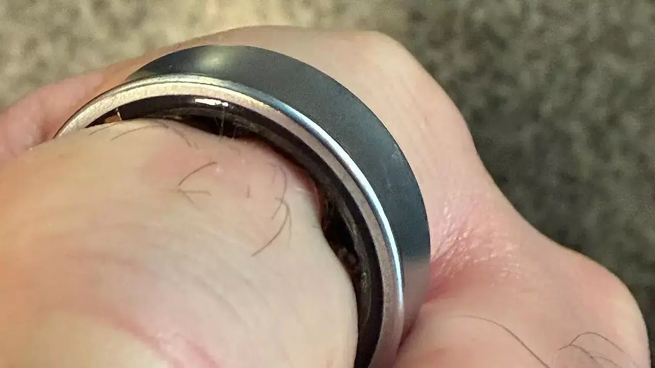 Samsung Galaxy Ring Şişme Olayı Korkuttu: Akıllı Yüzük Hastanede Kesilerek Çıkarıldı