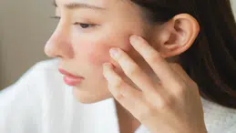 Soğuk Hava Cildi Zorluyor: Uzmanlardan Kuruluk ve Tahrişe Karşı Kış Uyarıları