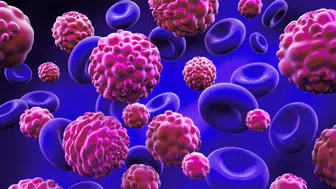 Yapay Zeka ile Kanser Tedavisinde Devrim: Kişiye Özel Kemoterapi Yaklaşımları