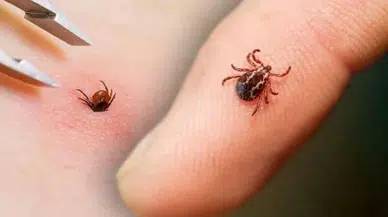 Uzmandan Hayati Uyarı: Yaz Aylarında KKKA Tehlikesine Dikkat!