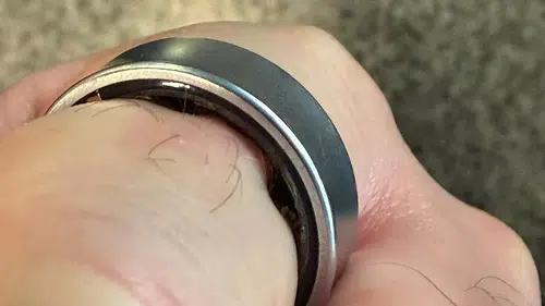 Samsung Galaxy Ring Şişme Olayı Korkuttu: Akıllı Yüzük Hastanede Kesilerek Çıkarıldı