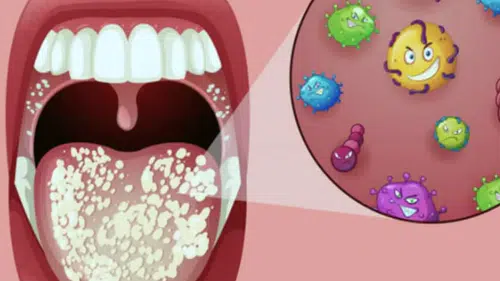 Kocaeli’de Bilim İnsanlarından Çarpıcı Uyarı