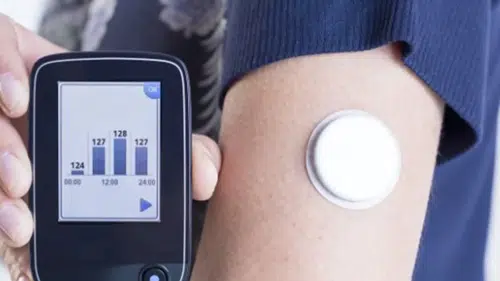 Kan Şekeri Artık Anbean İzleniyor: Sürekli Glikoz Takibi Sağlıklı Yaşamın Yeni Anahtarı