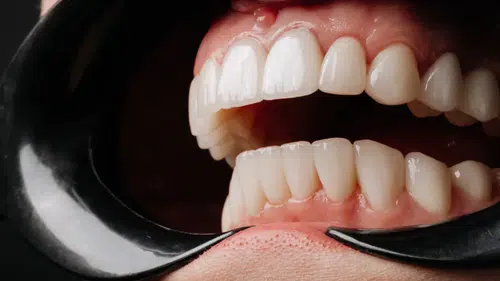 Ağızdaki Sorunlar Erken Ölüm Riskini Artırabiliyor