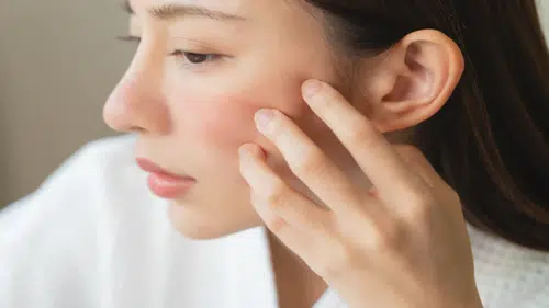 Soğuk Hava Cildi Zorluyor: Uzmanlardan Kuruluk ve Tahrişe Karşı Kış Uyarıları