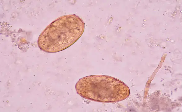Vücuda sızıp yıllarca fark edilmiyor: 78 ülkede görülen sinsi parazit alarmı