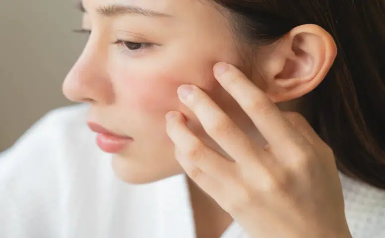 Soğuk Hava Cildi Zorluyor: Uzmanlardan Kuruluk ve Tahrişe Karşı Kış Uyarıları